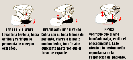 Respiracin de Salvamento