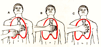 Compresión Cardíaca Externa