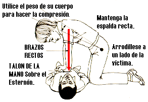 Compresión Cardíaca Externa