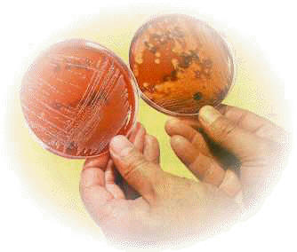 Cultivos bacterianos en placas de Petri